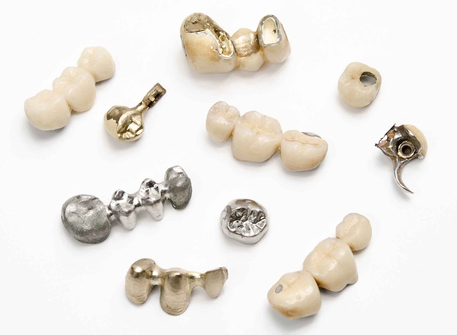 Dentalschrott